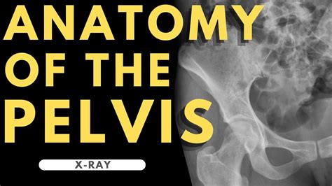 Pelvis Anatomy | Radiology anatomy part 1 prep | Pelvic X-ray interpretation - YouTube