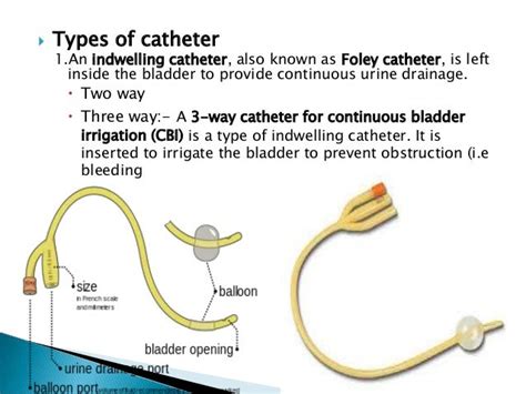 Foley Catheter Sizes French - Галерија слика