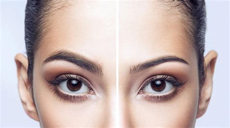 Thinning eyebrows and the treatments that can help