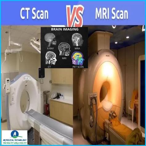 pet scan vs ct scan vs mri Archives