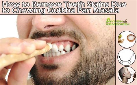 How to Remove Teeth Stains Due to Chewing Gutkha Pan Masala?