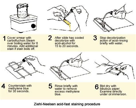 Ziehl-Neelsen acid-fast staining procedure | Medical Laboratories