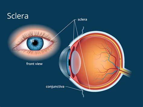 Best Retinopathy Treatment in Kerala | Anatomy of the Eye- Sclera