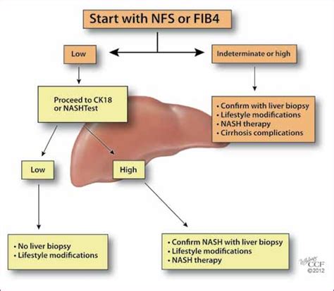 Figure 2 from Noninvasive Diagnosis of NASH and Liver Fibrosis Within the Spectrum of NAFLD ...