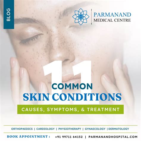 Understanding 11 Common Skin Conditions and Treatments