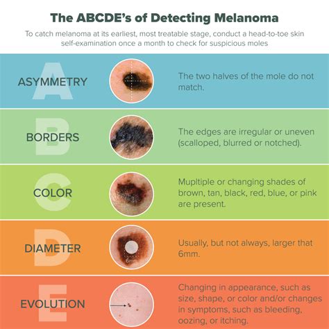 Pink Melanoma Symptoms