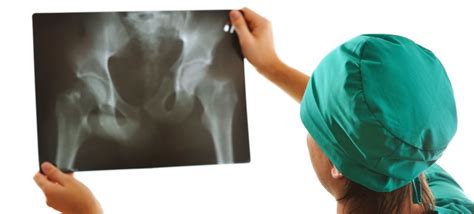 Coccydynia Diagnosis & Treatment | Dr. Stefano Sinicropi, M.D.