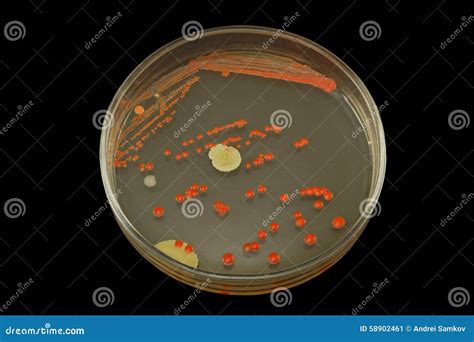 Red Bacterial Colonies on Petri Dish Isolated on Black Background Stock ...