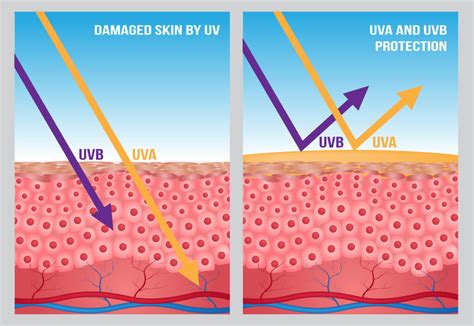 4 Ways UV Light Affects Your Vision | Sugiki Portis Yim