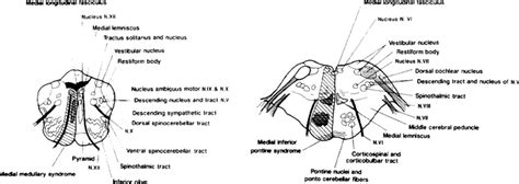 Foramen Cecum Embryology