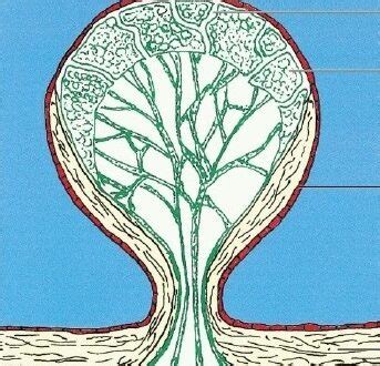 Arachnoid granulations Symptoms, Causes, Treatment