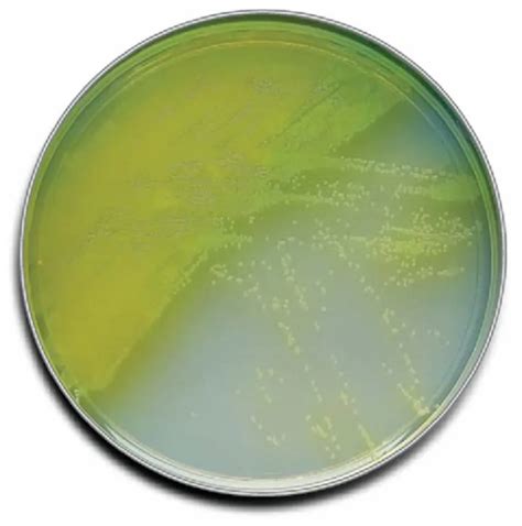 Borosilicate Glass (Plate) Cetrimide Agar Plate, Capacity: 10 ml at Rs 32/piece in Raigad