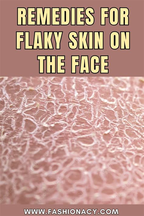 Remedies for Flaky Skin on the Face