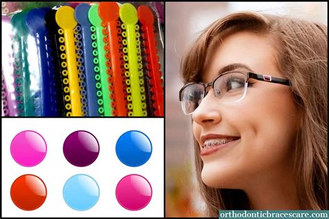 Best Braces Colors For Girls: How to choose - Orthodontic Braces Care