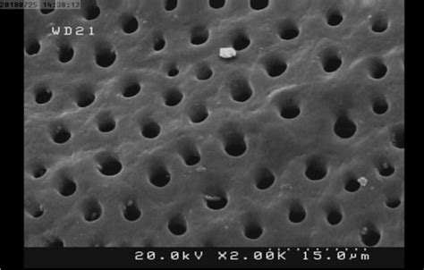 A 2000_view of the dentinal tubules openings | Download Scientific Diagram