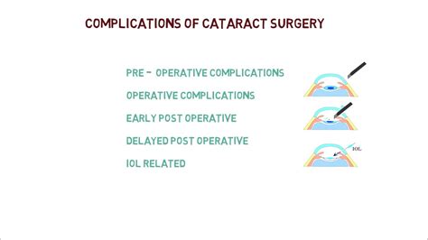 Cataract Surgery Complications in Elderly - DaneqoVillanueva