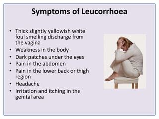 Leucorrhea Treatment, Causes & Symptoms - White Discharge | Doctor ...