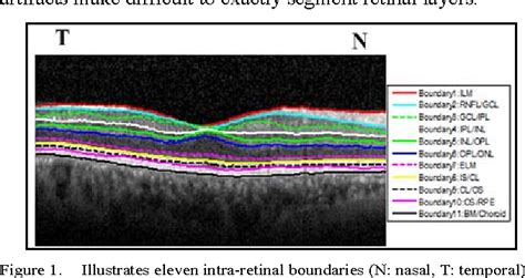 Figure 1 from Intra-retinal layers segmentation of macular OCT images based on the graph optimal ...