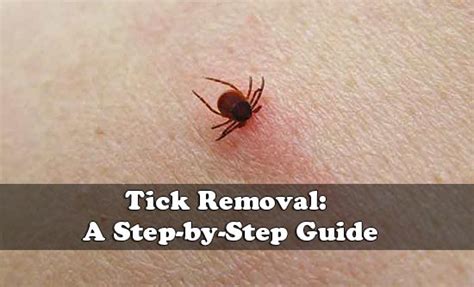 The Correct Way To Remove A tick