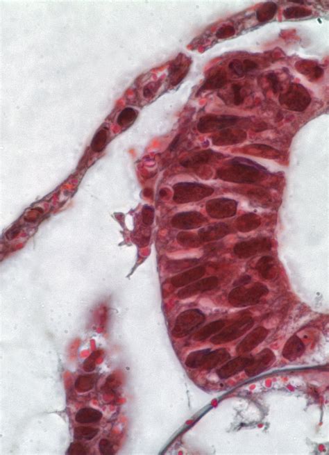 Development and evolution of the neural crest — The Gillis Lab