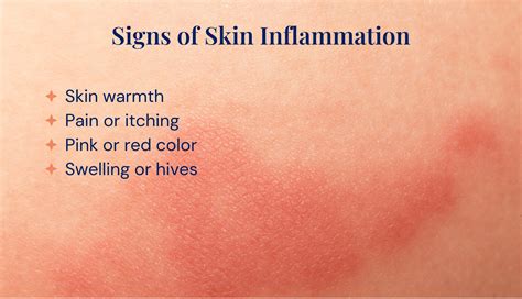 Skin Inflammation