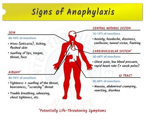 Signs And Symptoms Of Anaphylaxis Anaphylactic Shock Anaphylaxis | Hot Sex Picture