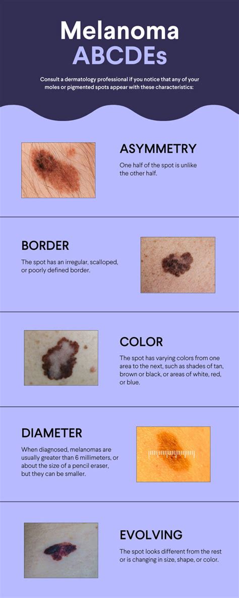 What causes brown spots on your face? Experts explain