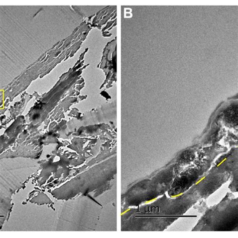 TEM images of an elytron. A, Ultrathin cross section. B, Enlarged from... | Download Scientific ...