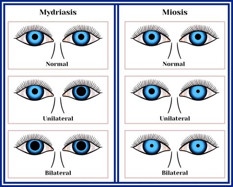 Miosis - Causes, Symptoms & Treatment Options