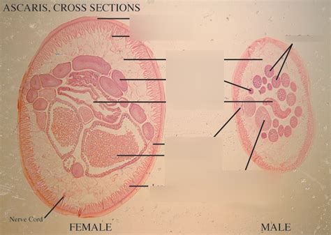 Ascaris cross section Diagram | Quizlet