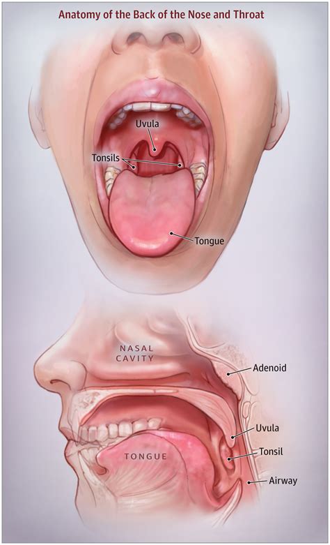 Adenoidectomy (Adenoid Removal) | Westside Head & Neck