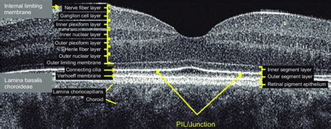 Retinal Layers Oct