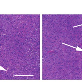 Histopathological damage in the liver tissue in the four groups of... | Download Scientific Diagram