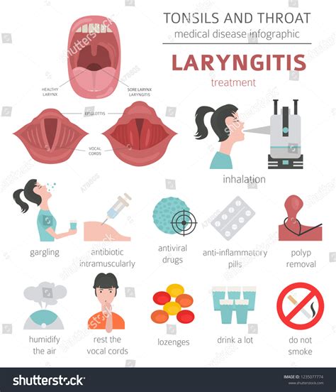 Tonsils Throat Diseases Laryngitis Symptoms Treatment Stock Vector (Royalty Free) 1235077774 ...