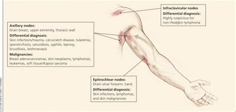 Female Groin Lymph Nodes Diagram