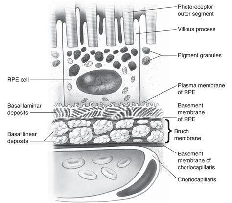 Basal laminar deposits and basal linear deposits t - American Academy of Ophthalmology