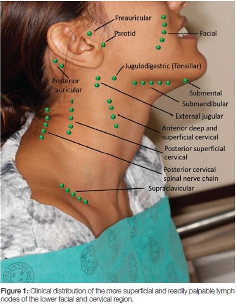 Lower facial and cervical lymphadenopathy in the context of clinical ...