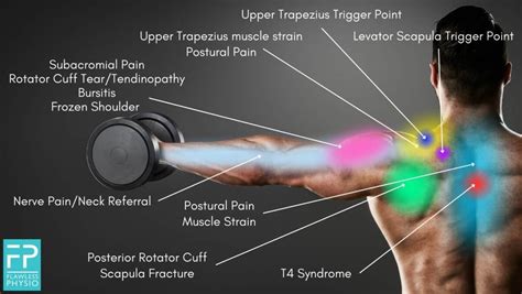 Shoulder Pain Diagnosis Chart | Shoulder Pain Location Chart