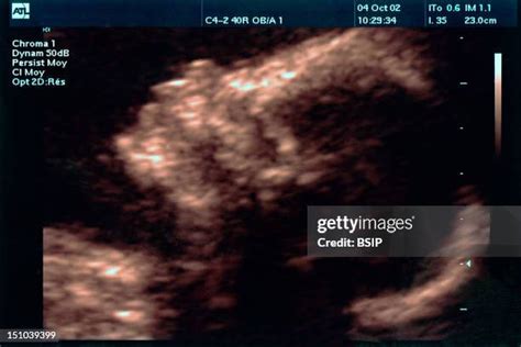 57 22 Weeks Pregnant Ultrasound Stock Photos, High-Res Pictures, and Images - Getty Images