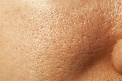 Extremely Large Pores: Causes & How to Minimize - Skin Care Geeks