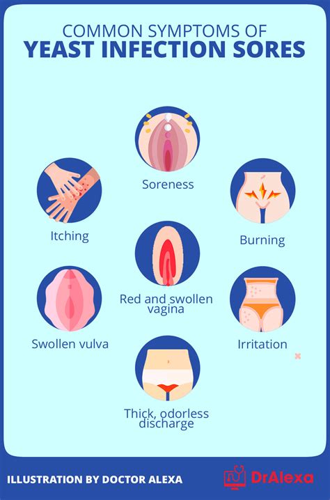 Yeast Infection Sores Vs Herpes