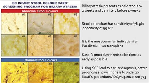 Medical Stool Color Chart