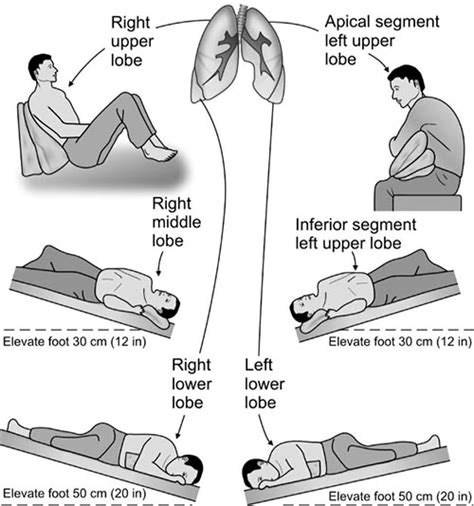 Manual Chest Physiotherapy