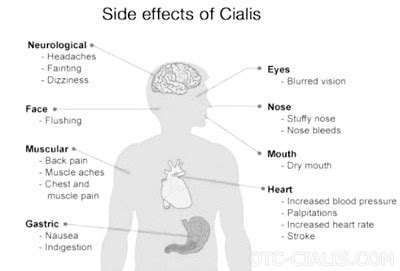 Tadalafil (Generic Cialis) Side Effects