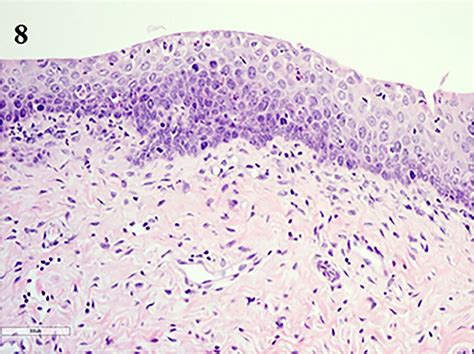 Histology of the vagina in dioestrus. In early dioestrus, both the... | Download Scientific Diagram