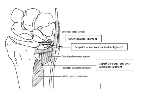 Ulnar Collateral Ligament Wrist Mri