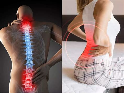 Is there severe pain due to pressure on the nerves of the body? These 5 ...