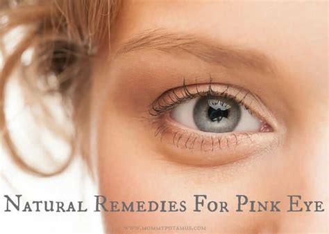 5 Natural Remedies For Pink Eye