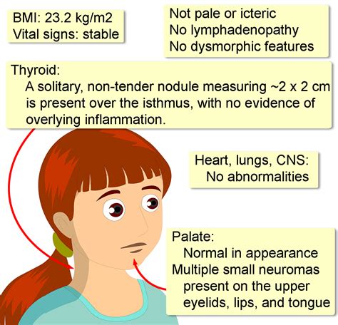 Multiple Endocrine Neoplasia Type 2 - Interactive case study | Clinical Odyssey by Medical ...