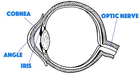 Narrow Angle Glaucoma - How it Affects Vision - Eye Bulletin